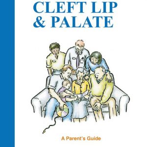 The Treatment of Cleft Lip and Palate: A Parent's Guide