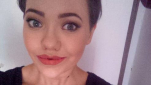 A woman with Van Der Woude Syndrome at 21 years old