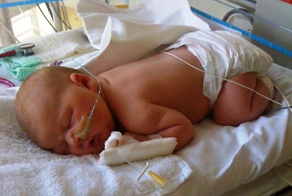 Jessica at one day old in the Special Care Baby Unit (SCBU)