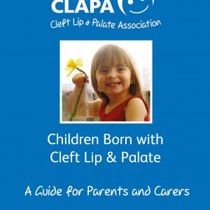 Children Born With Cleft Lip & Palate: Guide for Parents and Carers