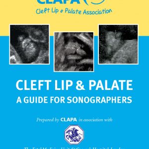 Cleft Lip & Palate: A Guide for Sonographers