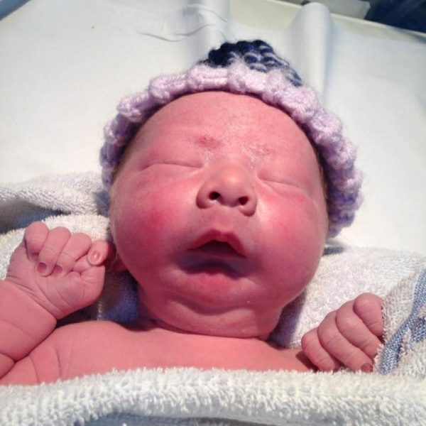 Cleft Lip & Palate Association