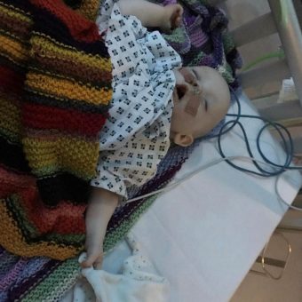 A baby in a hospital gown with a feeding tube lies on their back sleeping