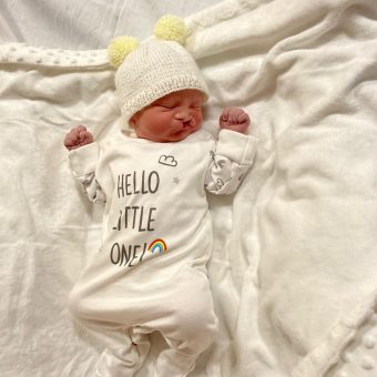 A newborn baby with a cleft lip is lying on a white sheet wearing a white babygrow and hat
