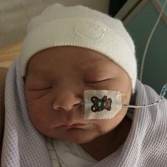A baby with a feeding tube taped to their face, wearing a white hat. Their eyes are closed.