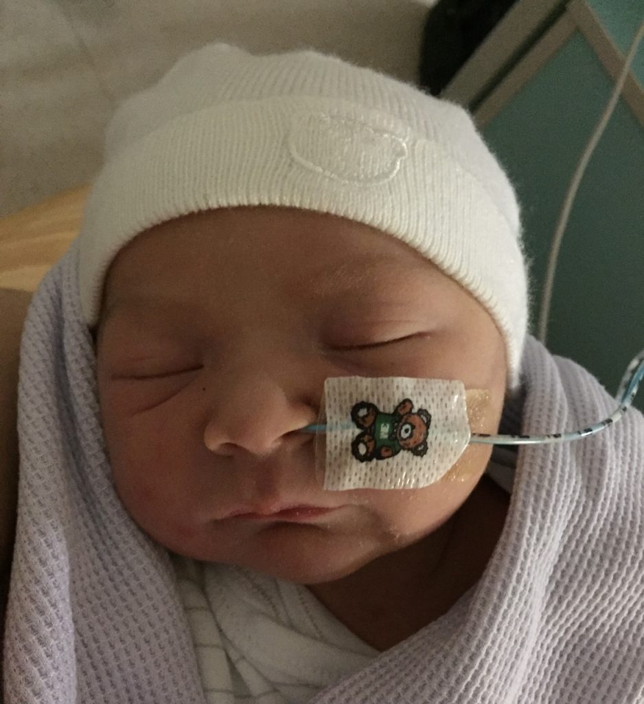 A baby with a feeding tube taped to their face, wearing a white hat. Their eyes are closed.