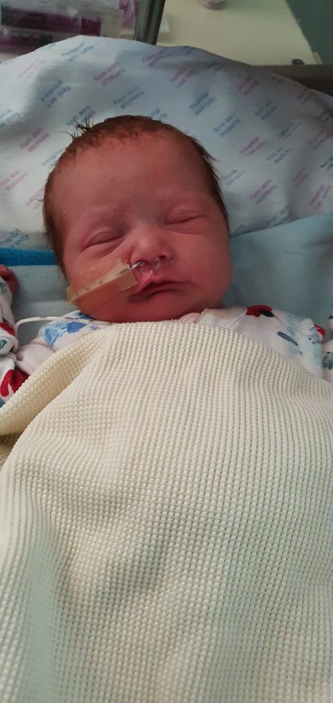 A baby lying down asleep with a feeding tube in their nose