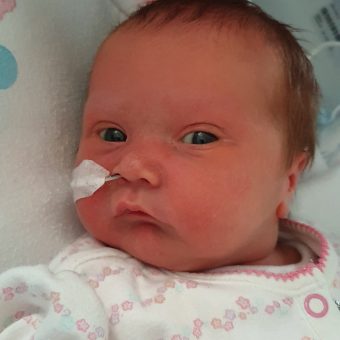 A baby with a feeding tube in their nose looking at the camera