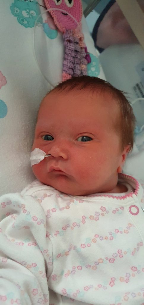 A baby with a feeding tube in their nose looking at the camera