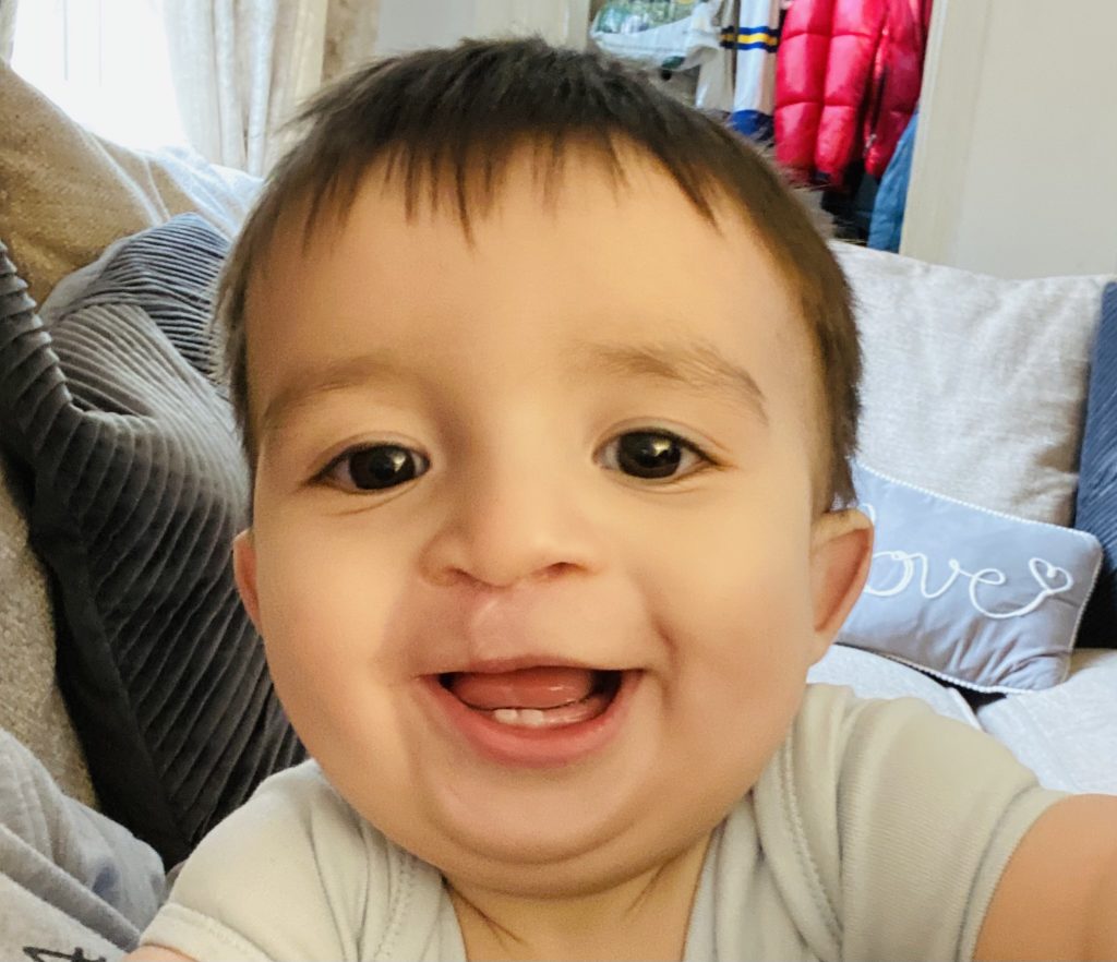 A young child with brown hair and yes is smiling widely close to the camera, with a faint scar above their lip