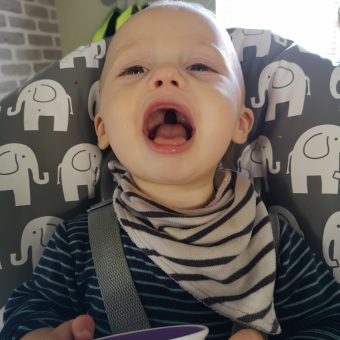 A baby is sitting in an elephant high chair with their mouth open, showing their cleft palate