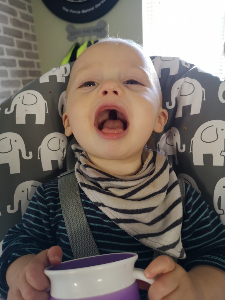 A baby is sitting in an elephant high chair with their mouth open, showing their cleft palate