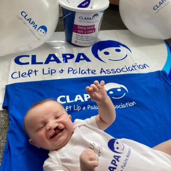 A baby wearing a CLAPA babygrow, lying on a CLAPA t shirt and banner with a collection box in the background
