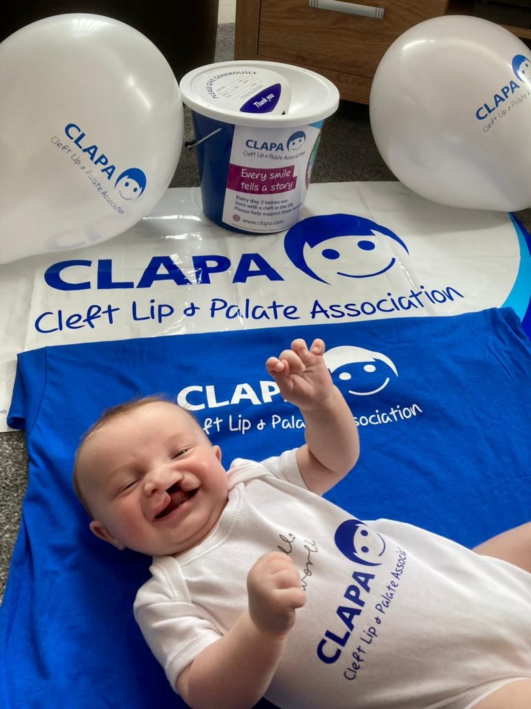 A baby wearing a CLAPA babygrow, lying on a CLAPA t shirt and banner with a collection box in the background