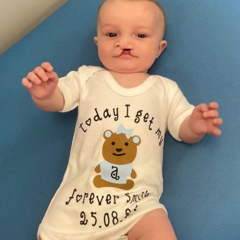 a baby lying on a hospital bed wearing a babygrow saying 'today I get my forever smile';