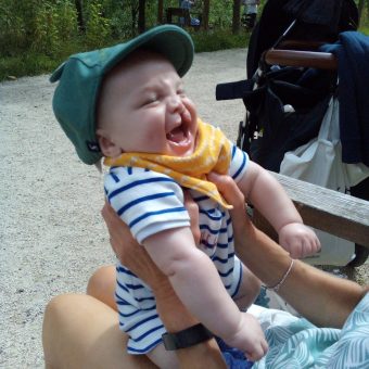 A baby with a cleft lip and wearing a green cap is laughing