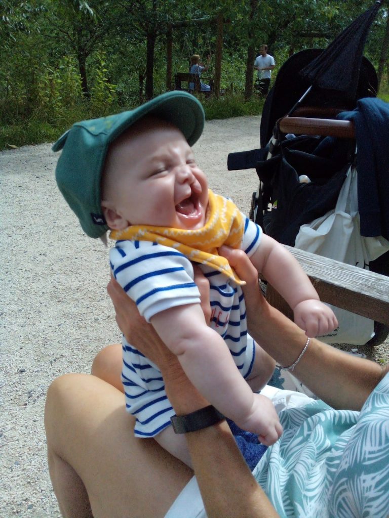A baby with a cleft lip and wearing a green cap is laughing