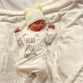 A newborn baby with a cleft lip is sleeping on a white sheet wearing a white wooly hat and babygrow