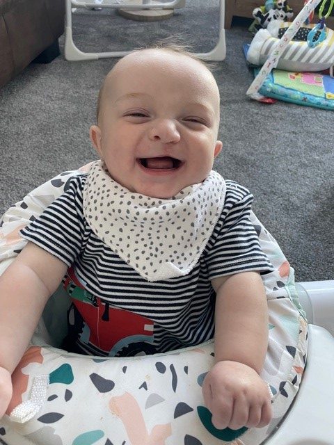 A baby post-op recovered and laughing